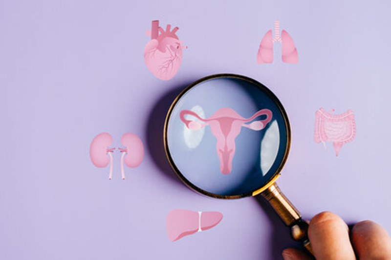 pcos